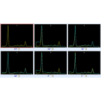 Immunotypowanie białek surowicy i moczu
