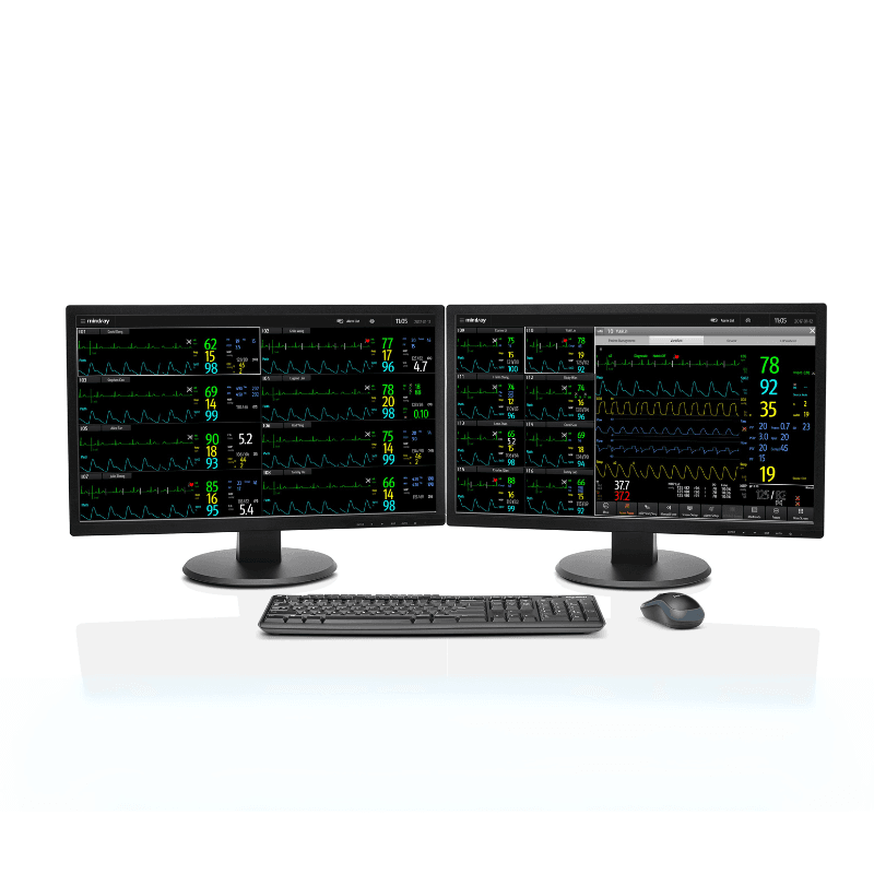 System centralnego monitorowania Mindray BeneVision™ CMS