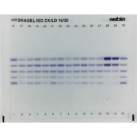 Izoenzymy i Lipoproteiny