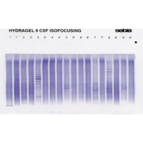 Prążki oligoklonalne