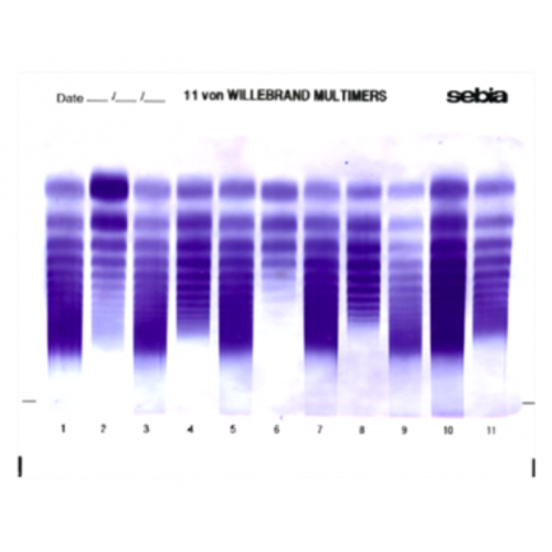 Multimery czynnika von Willebranda