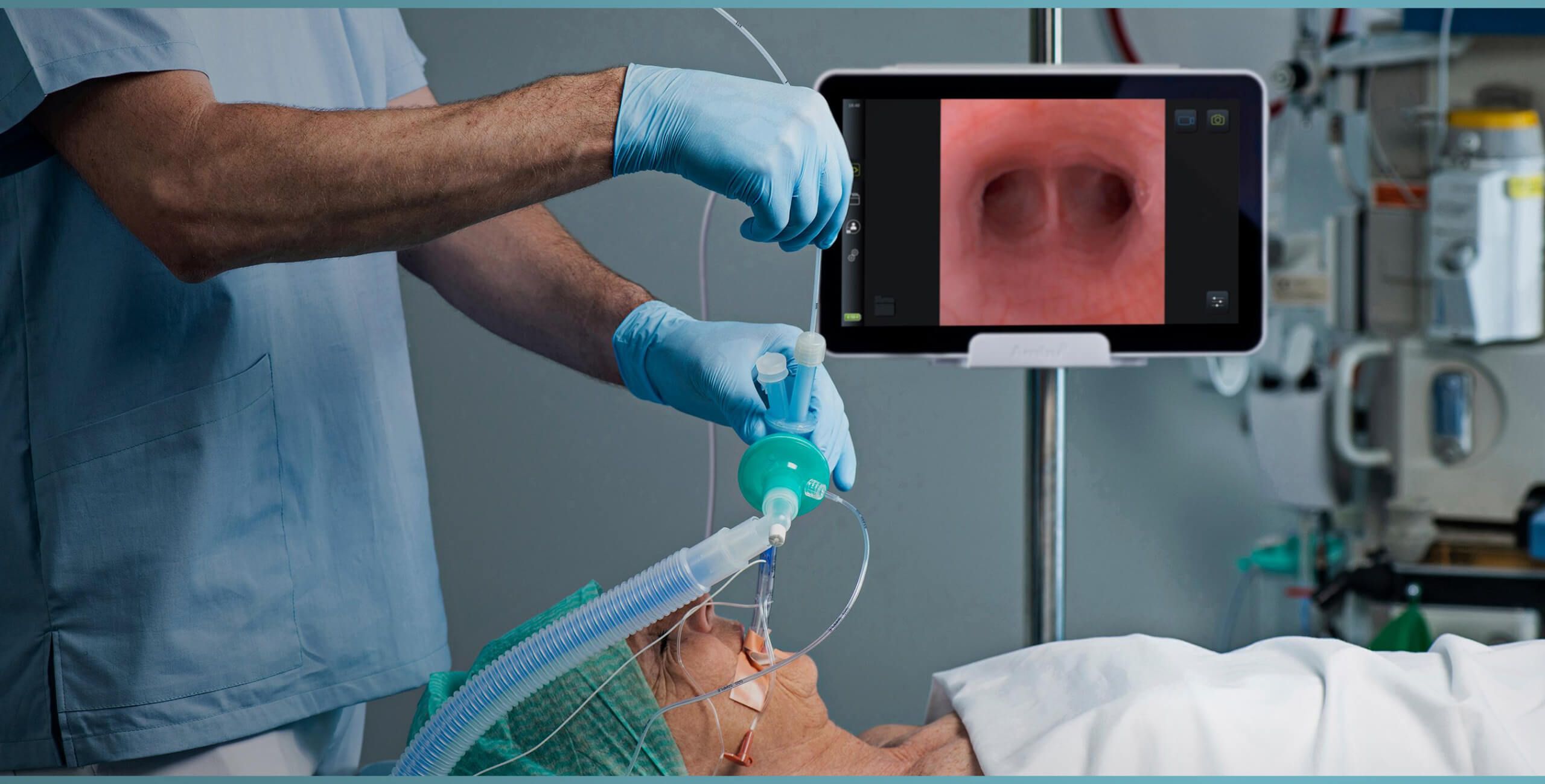 Rurki do wentylacji płuca