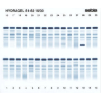 Elektroforeza białek surowicy i moczu
