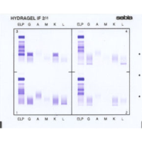 Immunofiksacja białek surowicy