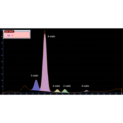 Desialowana transferyna – CDT