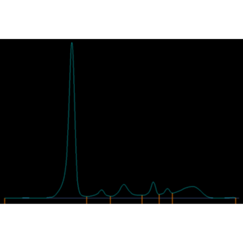 Elektroforeza białek surowicy i moczu