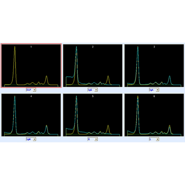 Immunotypowanie